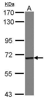 Polyclonal Rabbit anti-Human Epsin 1 / EPN1 Antibody (WB)