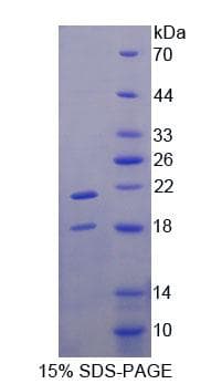Human TRPV6 Protein (Recombinant His-T7)