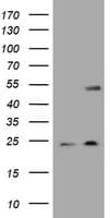 KRT20 / CK20 / Cytokeratin 20 Antibody (aa1-266, clone OTI4A2, Carrier-free)