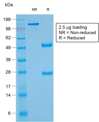 Recombinant Monoclonal Mouse anti-Human GYPA / CD235a / Glycophorin A Antibody (clone rGYPA/280, IHC)