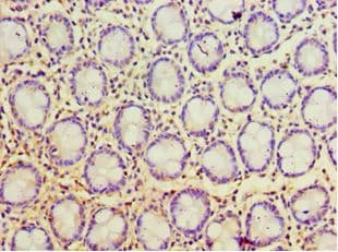 Polyclonal Rabbit anti-Human POP7 Antibody (aa1-140, IHC, WB)