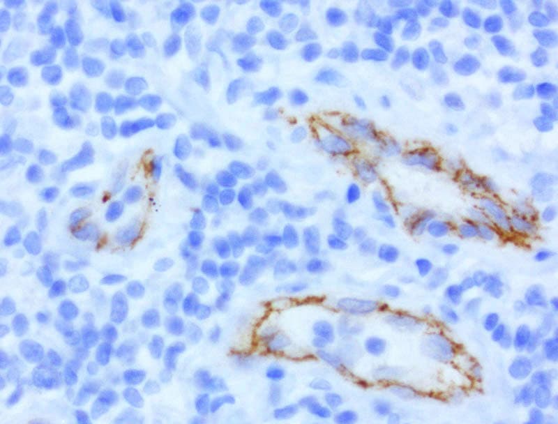 CDH2 / N Cadherin Antibody (clone UMAB23, Carrier-free)