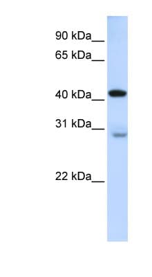 GRAMD2 Antibody (aa144-193)