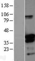 DNTTIP1 / TDIF1 Protein (Over-Expression Lysate Myc-DDK (Flag))
