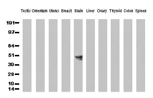 BMP4 Antibody (aa293-408, clone UMAB42)