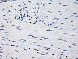 Monoclonal Mouse anti-Human PRDX4 / Peroxiredoxin 4 Antibody (clone OTI9A3, IHC, IF, WB)