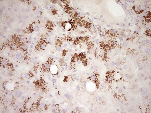FOS / c-FOS Antibody (clone OTI1F12)