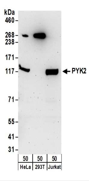 PTK2B / PYK2 Antibody (aa959-1009)