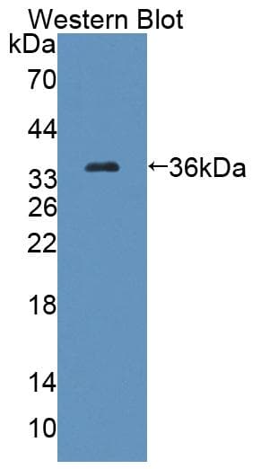 MCAD / ACADM Antibody