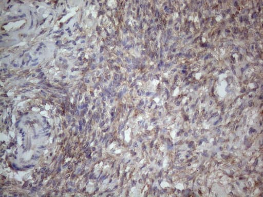 Monoclonal Mouse anti-Human MTF-1 Antibody (clone OTI2F3, aa1-272, IHC, WB)