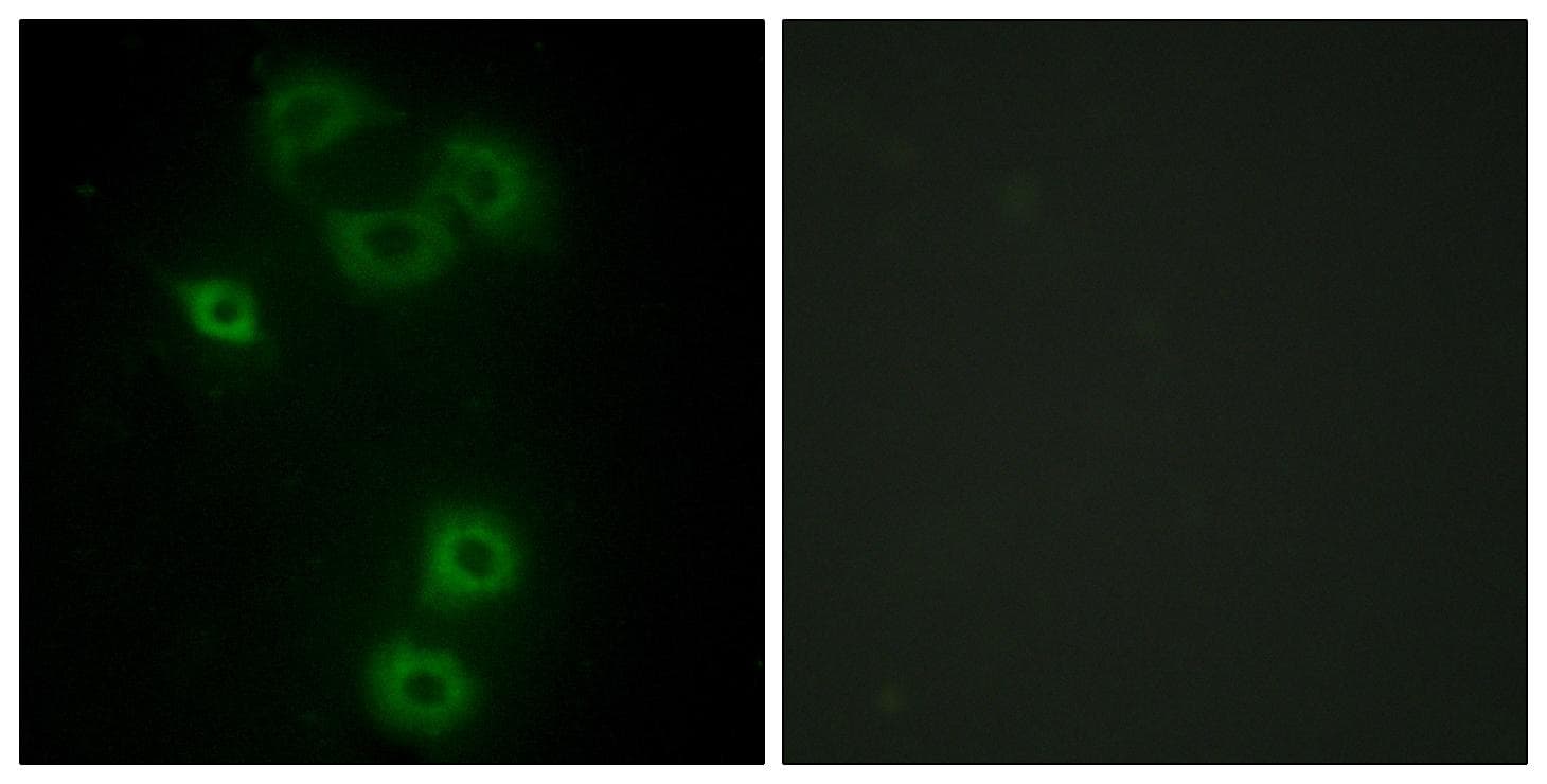 Polyclonal Rabbit anti-Human ETK / BMX Antibody (IHC, IF, WB)