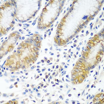 ATAD3A Antibody
