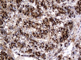 GLB1 / Beta-Galactosidase Antibody (clone OTI1C9)