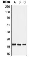Polyclonal Rabbit anti-Human LTA / TNF Beta Antibody (Internal, WB)