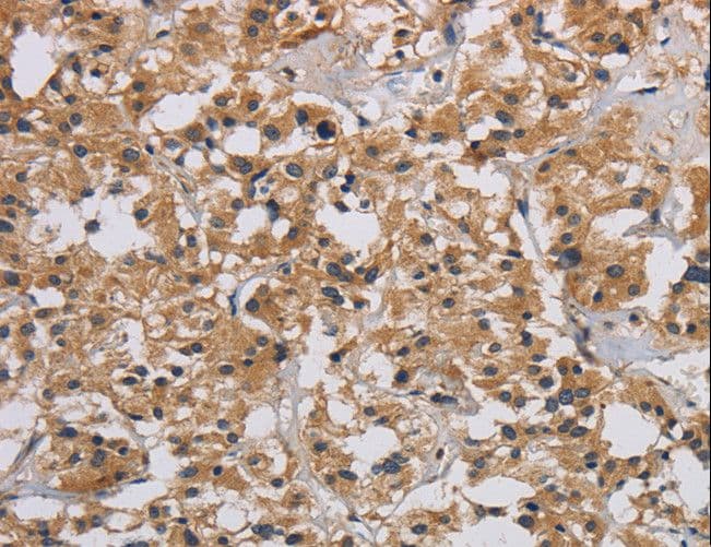 Polyclonal Rabbit anti-Human INPPL1 / SHIP2 Antibody (IHC)