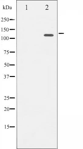 Polyclonal Rabbit anti-Human RB1 / Retinoblastoma / RB Antibody (phospho-Ser780, IHC, IF, WB)