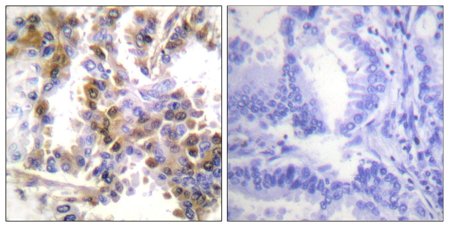 EIF4EBP1 / 4EBP1 Antibody