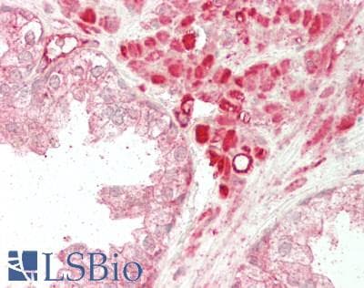 IHC-plus™ MYH9 Antibody (aa 2-241)