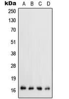 TGFA / TGF Alpha Antibody (C-Terminus)