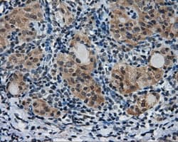 PTPRE / PTP Epsilon Antibody (clone OTI5E8)