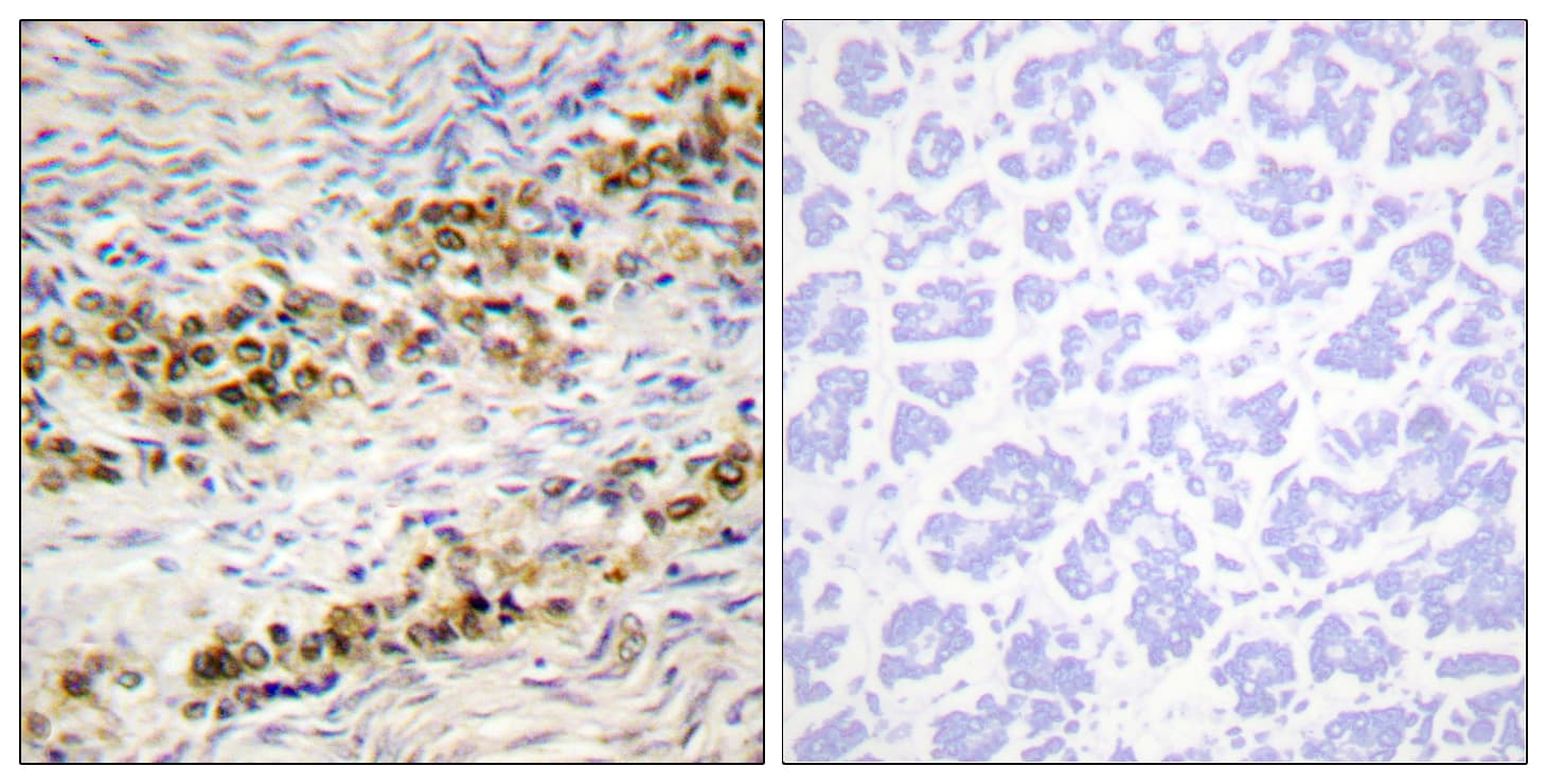 AKT1 Antibody (phospho-Ser246)