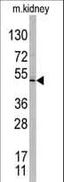 Polyclonal Rabbit anti-Human TASP1 Antibody (aa364-395, IHC, WB)