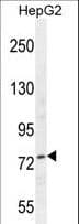 NCL / Nucleolin Antibody (aa428-455)