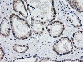 ACY1 / Aminoacylase 1 Antibody (clone OTI1D4)