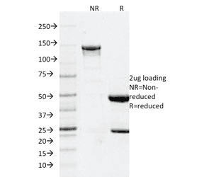 GFAP Antibody (clone GFAP/2076)