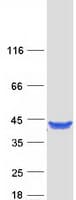 Human GRHPR / Glyoxylate Reductase Protein (Recombinant Myc-DDK (Flag))
