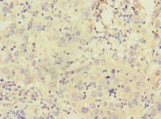 Polyclonal Rabbit anti-Human CALCR / Calcitonin Receptor Antibody (IHC, WB)