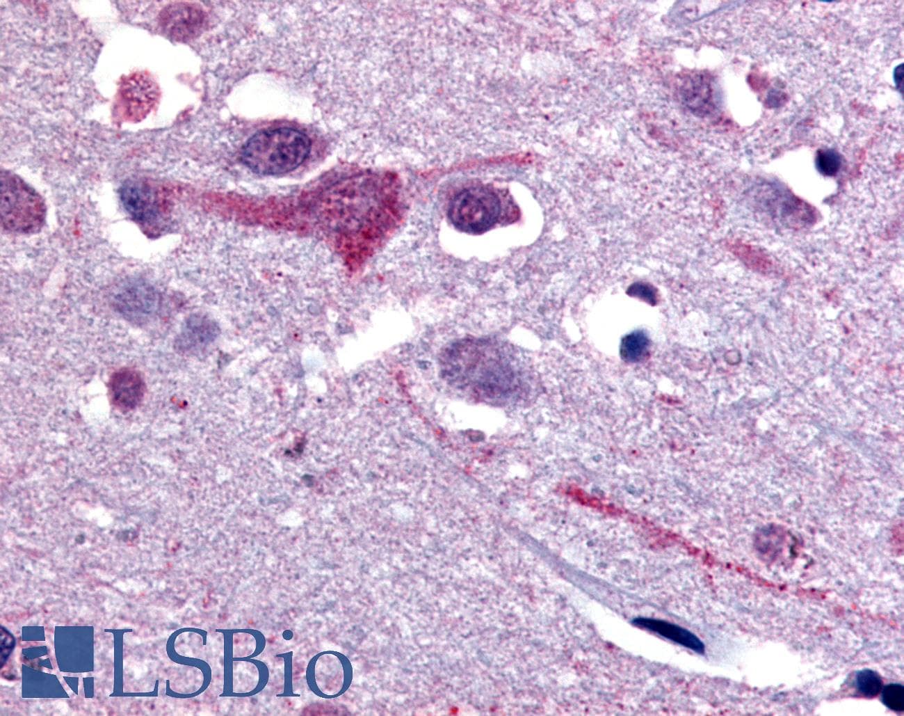 IHC-plus™ Polyclonal Rabbit anti-Human SLC5A9 / SGLT4 Antibody (C-Terminus, IHC)