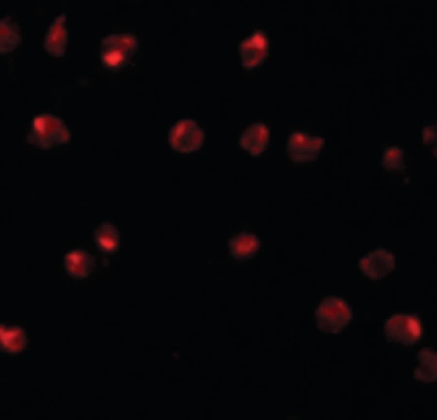 ZNF281 / Zfp281 Antibody