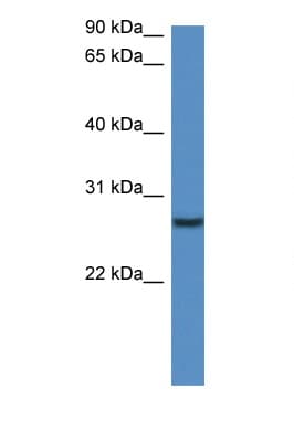 Polyclonal Rabbit anti-Mouse CLEC1B / CLEC-2 Antibody (HRP, N-Terminus, IHC, WB)