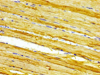 CASQ2 / Calsequestrin 2 Antibody