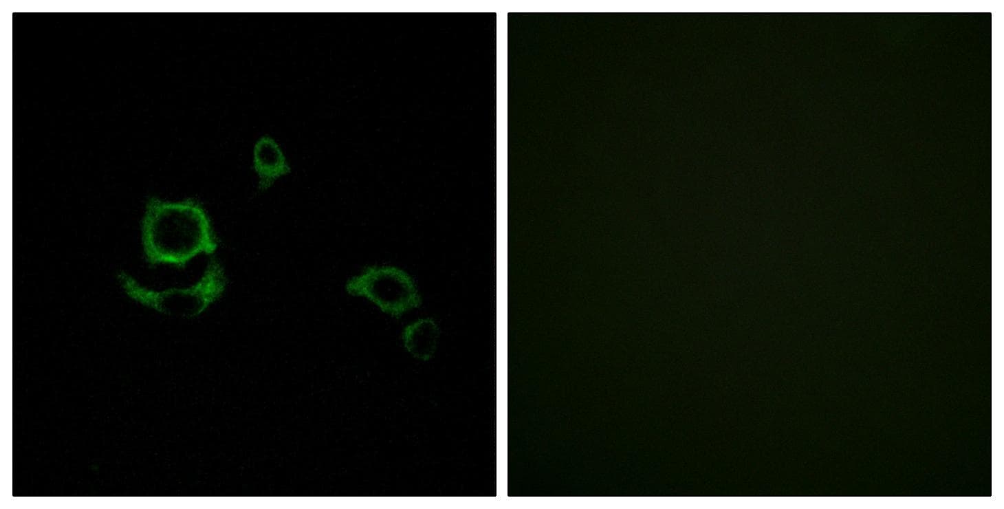 F13B / TGase Antibody