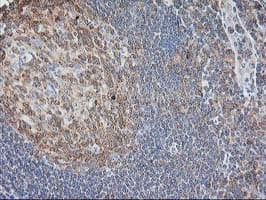 MAPRE2 / EB2 Antibody (clone OTI5F3)