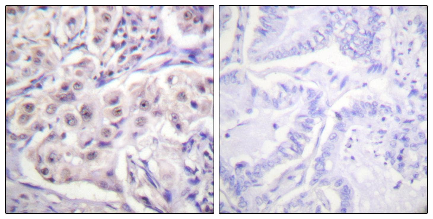 HNRNPD / AUF1 Antibody (p83)