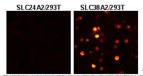 Polyclonal Rabbit anti-Human SLC38A2 / SNAT2 Antibody (IHC, WB)