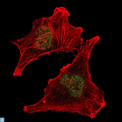 SUZ12 Antibody