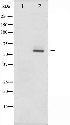 Polyclonal Rabbit anti-Human ESR2 / ER Beta Antibody (aa94-118, IHC, IF, WB)