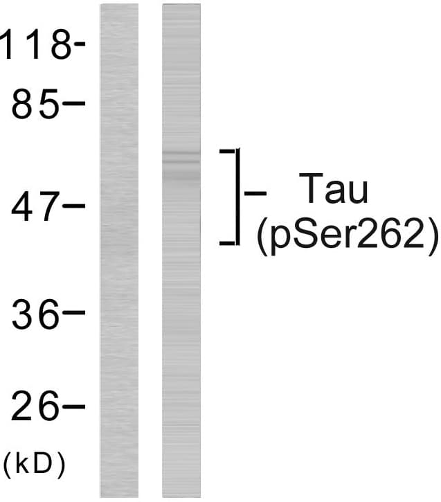 MAPT / Tau Antibody (phospho-Ser262)