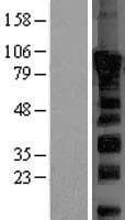 Human DVL2 / Dishevelled 2 Protein (Over-Expression Lysate Myc-DDK (Flag))