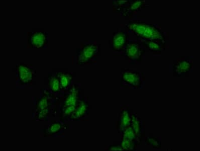 CDKN1C / p57 Kip2 Antibody