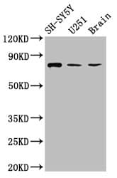 Neurochondrin Antibody