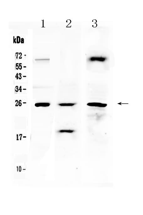 Polyclonal Rabbit anti-Human TIMP4 Antibody (IHC, WB)