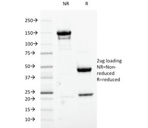 CDK1 / CDC2 Antibody (clone A17.1.1)