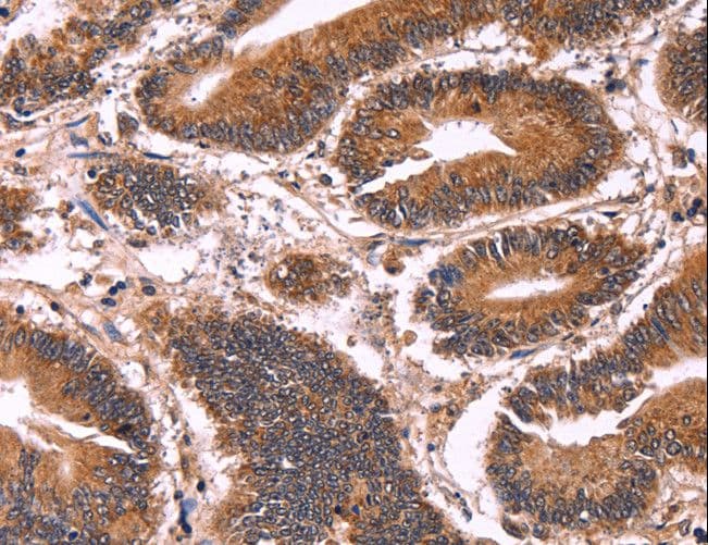 Polyclonal Rabbit anti-Human CCDC106 Antibody (IHC)