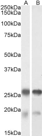 IHC-plus™ TPPP Antibody (aa21-35)