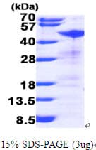 Human RRM2 Protein (Recombinant His)